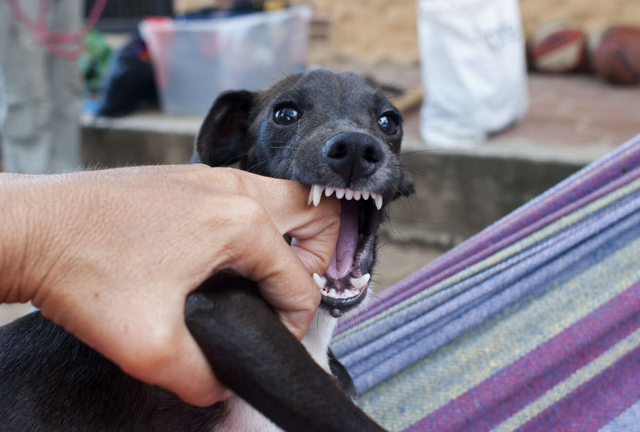 A Dog Bites the person's hand, in this image shows that if you need Dog Bite Attorney.